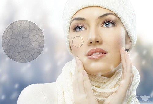 نکاتی برای زیبا ماندن در زمستان