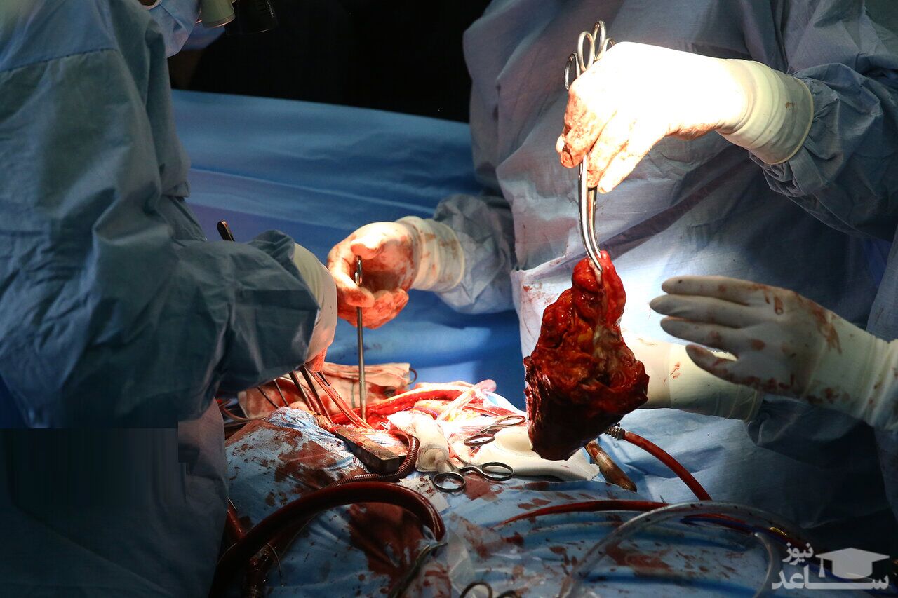 سفر قلب نوجوان خوزستانی با جت برای نجات جان کودک ۸ ساله تهرانی