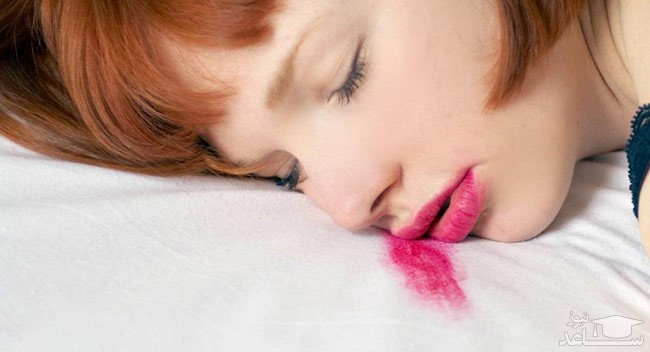 نحوه پاک کردن رژ لب از لباس