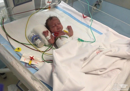 سنگین‌ترین جراحی قلب بر روی نوزاد ١۴٠٠گرمی