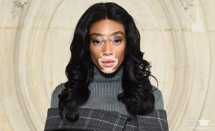 پوستر بیماری پوستی پیسی 