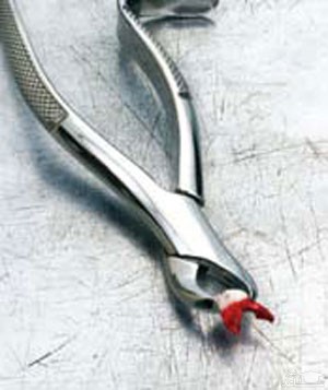   تأثیر کشیدن دندان بر زیبایی و روح و روان انسان ها