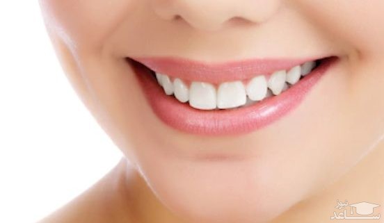 چه مواد غذایی برای دندان مضر است؟