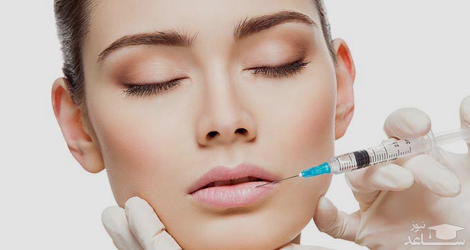 تزریق به لب یک خانم