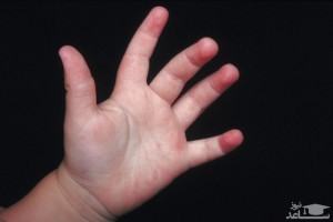 چه عاملی موجب چپ دست شدن کودک میشود؟