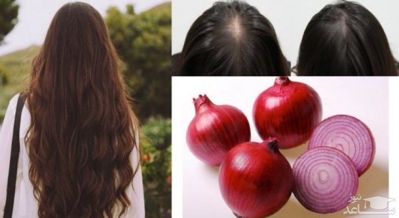 فواید آب پیاز برای مو