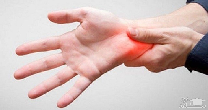 درد مچ دست: درمان درد مچ دست با فیزیوتراپی و ورزش