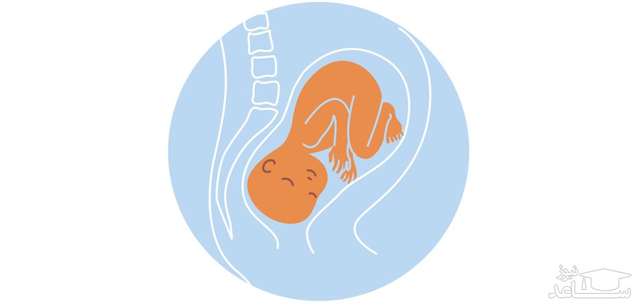 جفت در رحم کجا لانه‌گزینی می‌کند؟ بررسی انواع موقعیت‌های جفت