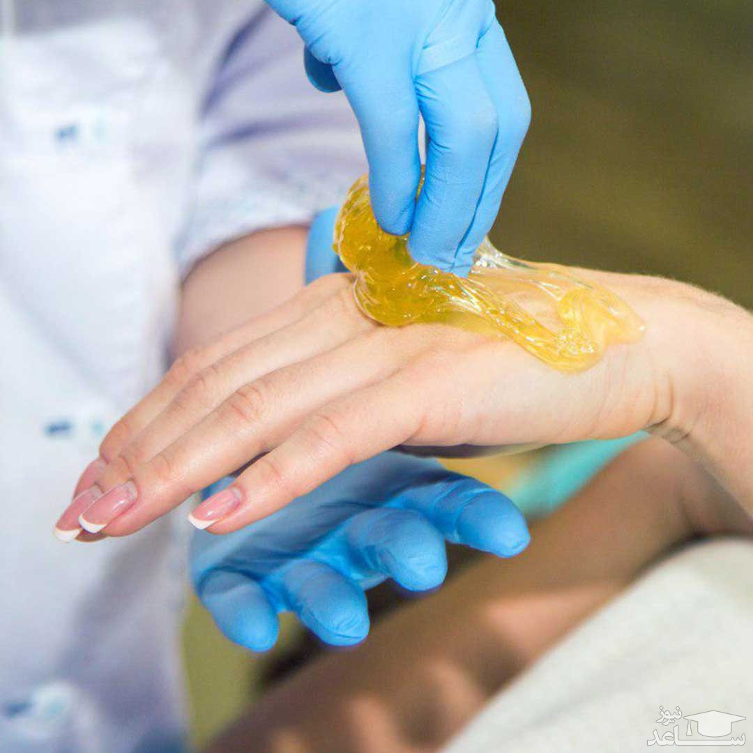 بداشتن موم از روی پوست دست
