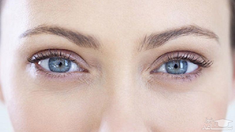 برای برطرف‌کردن احساس پیری و خستگی چشم‌ها