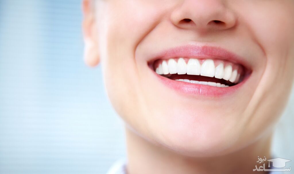 مراقبت های لازم بعد از انجام بلیچینگ (سفید کردن و جرم گیری) دندان