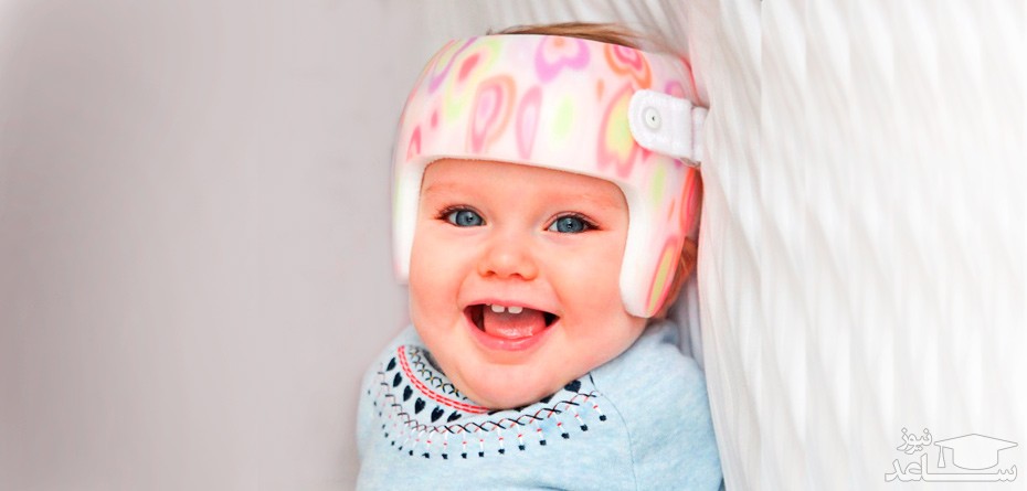روش های درمان صاف و بیضی شدن سر نوزاد