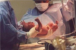 تاثیر شیمی درمانی و رادیو تراپی بر ناباروری و نازایی