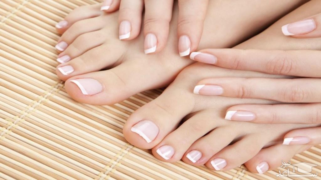 عفونت پوستی پارونیشیا چیست؟