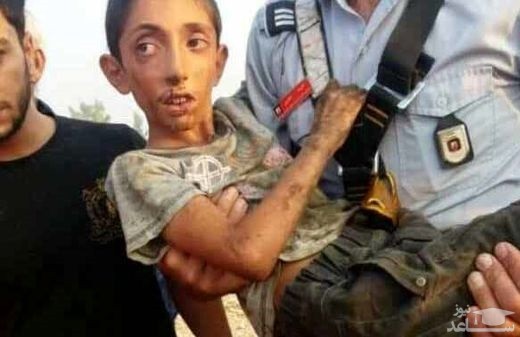 تصویر تلخ از پسر 9 ساله که توسط مادرش به چاه انداخته شده بود