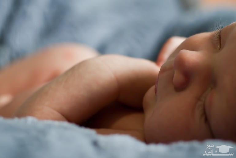 روش‌های پیشگیری از درماتیت سبوره در نوزادان چیست؟