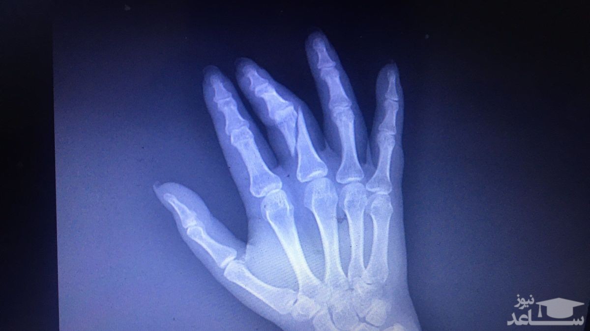 (فیلم) ماجرای شکستن دست خبرنگار توسط حراست دانشگاه شهید بهشتی