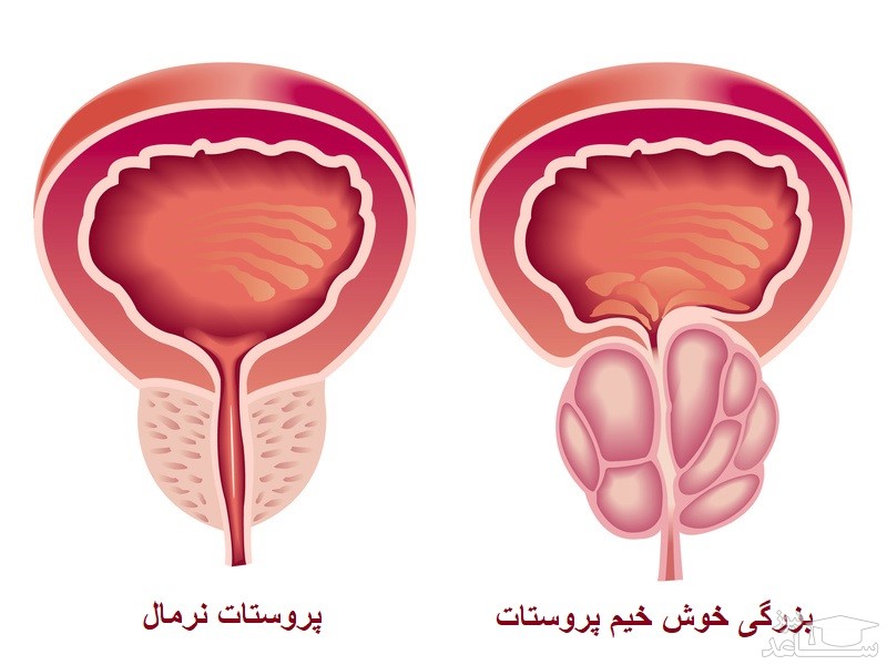 میزان، تاثیرات و مکانیزم اثر  زیتیگا