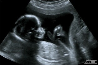 تاثیر انگل ها بر قدرت باروری زنان