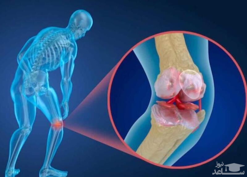 میزان، تاثیرات و مکانیزم اثر قرص استئوفوس