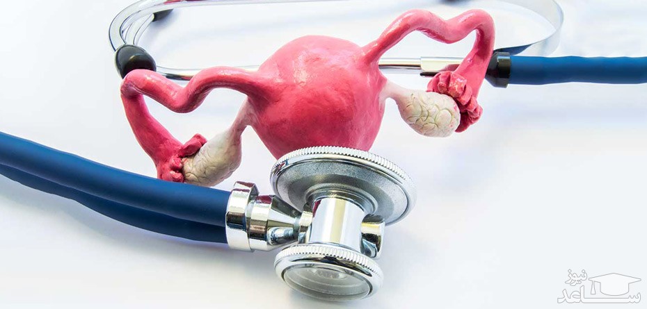 آتونی رحم چیست و چه علائمی دارد؟