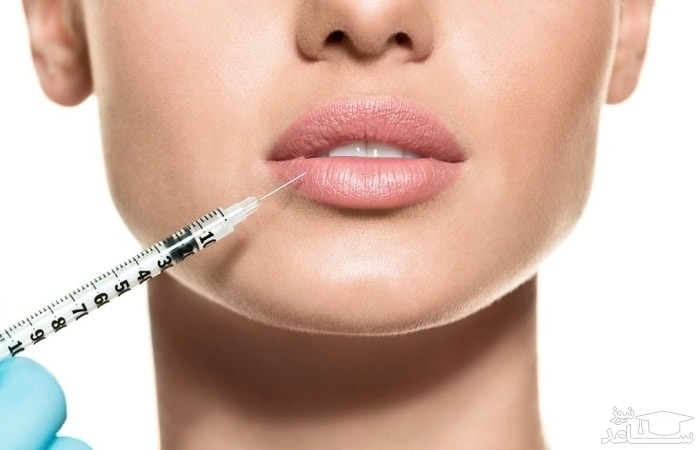 تزریق به لب
