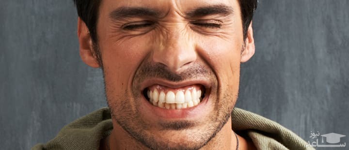 علل و درمان براکسیسم یا دندان قروچه