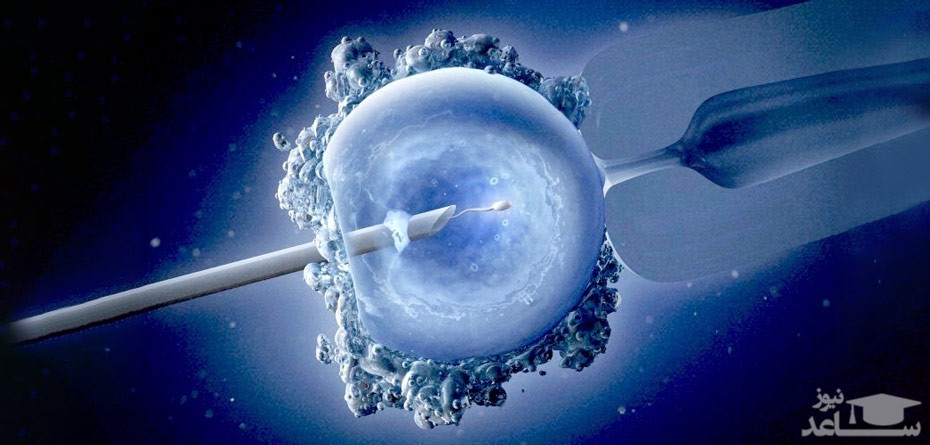همه چیز درباره عمل آی وی اف IVF  برای درمان نازایی