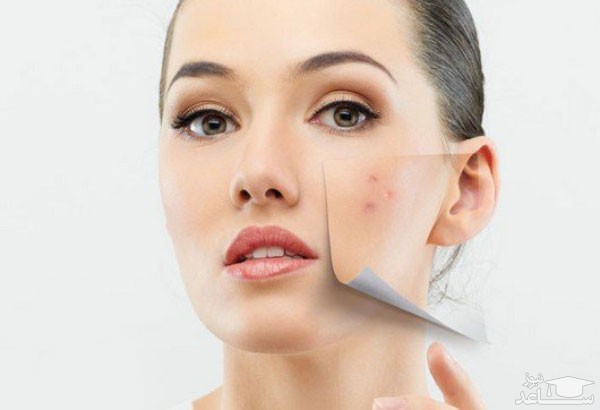 میزان مصرف، تاثیرات و مکانیزم اثر ژل آداپالن