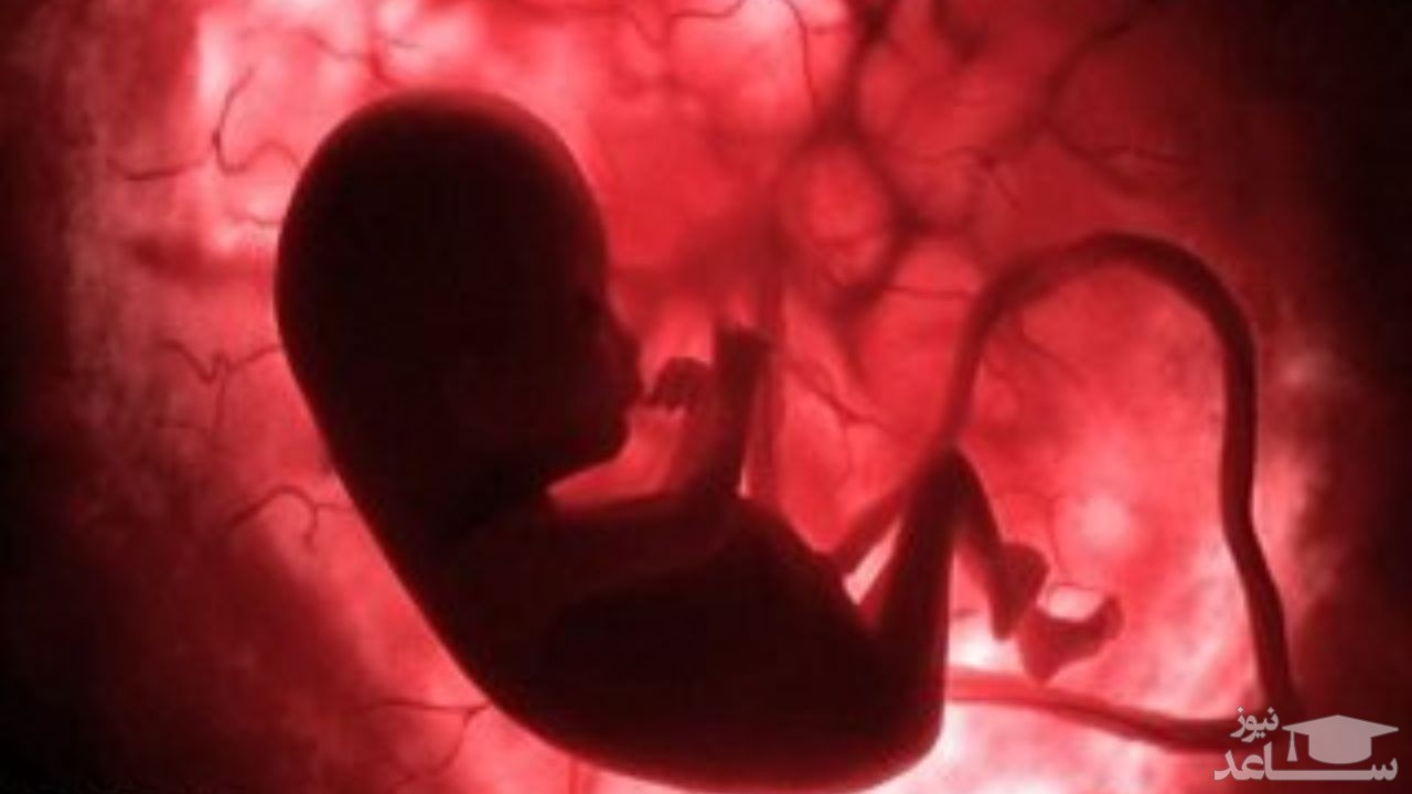 جزئیات طرح جدید مجلس برای سقط جنین