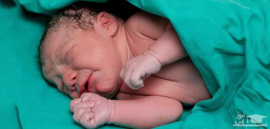 علت تولد نوزاد با سوراخ بین دهلیزی قلب