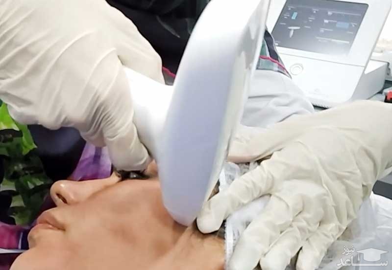 زیبایی پوست با دستگاه ونوس ویوا