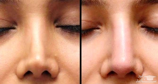 مقایسه بینی