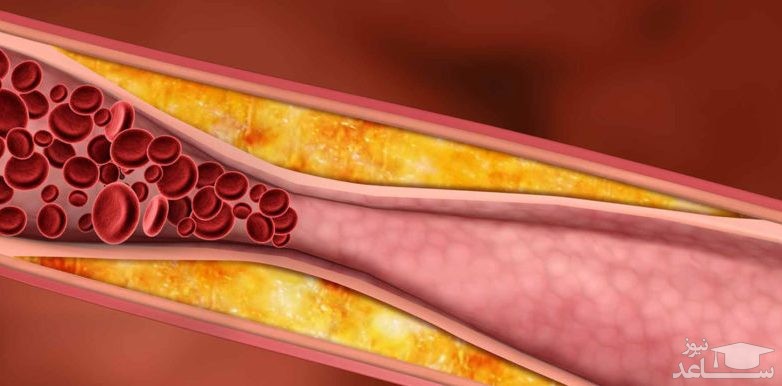 عوارض و موارد مصرف كپسول جم فیبروزیل