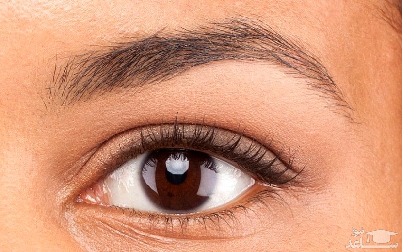 علل ریزش مژه و راههای درمان ان