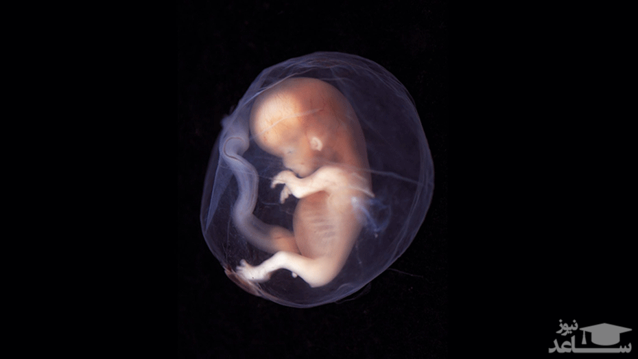 شرایط بارداری بعد از سقط جنین
