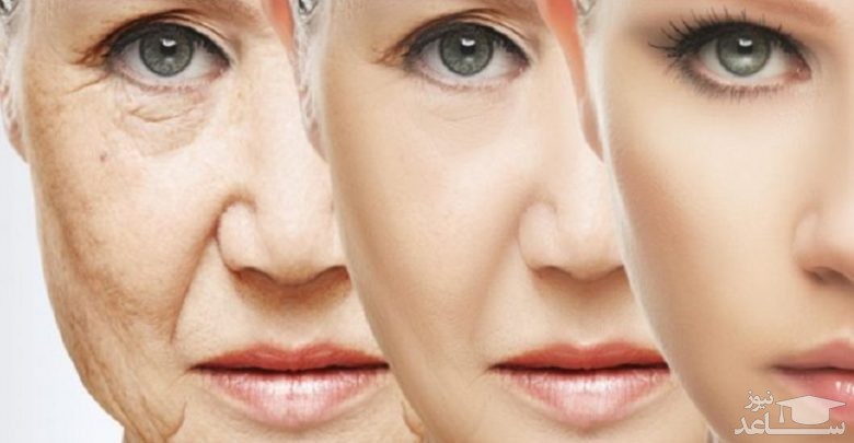 روش هایی برای جلوگیری از پیر شدن پوست