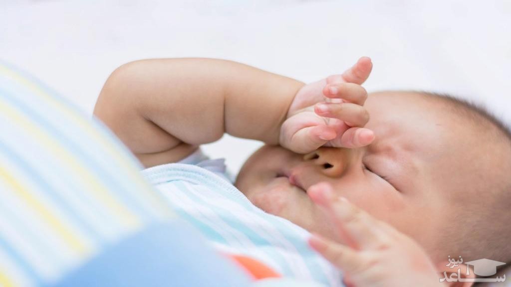 دلایل مالیدن چشم در نوزادان و کودکان