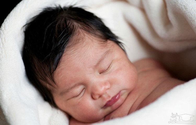 ریزش موی طبیعی و غیر طبیعی در نوزادان و کودکان