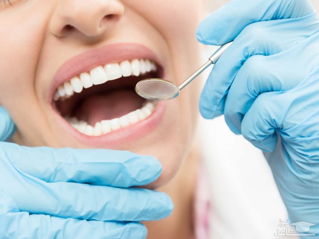 علل فاصله‌دار شدن دندان‌ها چیست؟