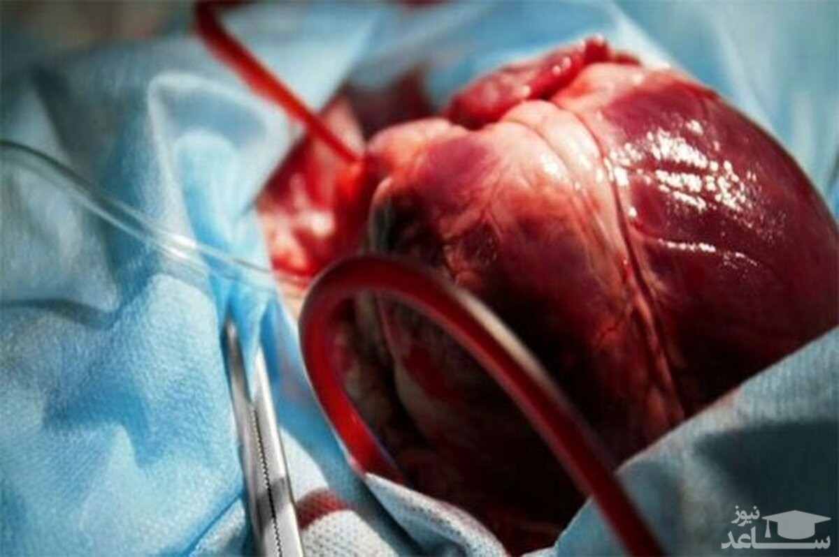 انتقال چندصدکیلومتری قلب اهدایی در سردترین روز سال