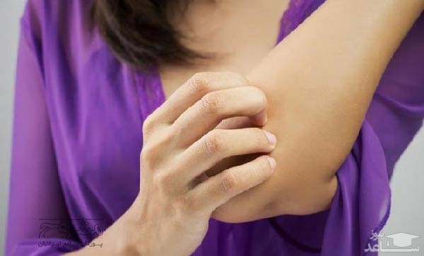 موارد منع مصرف و تداخل دارویی کالامین