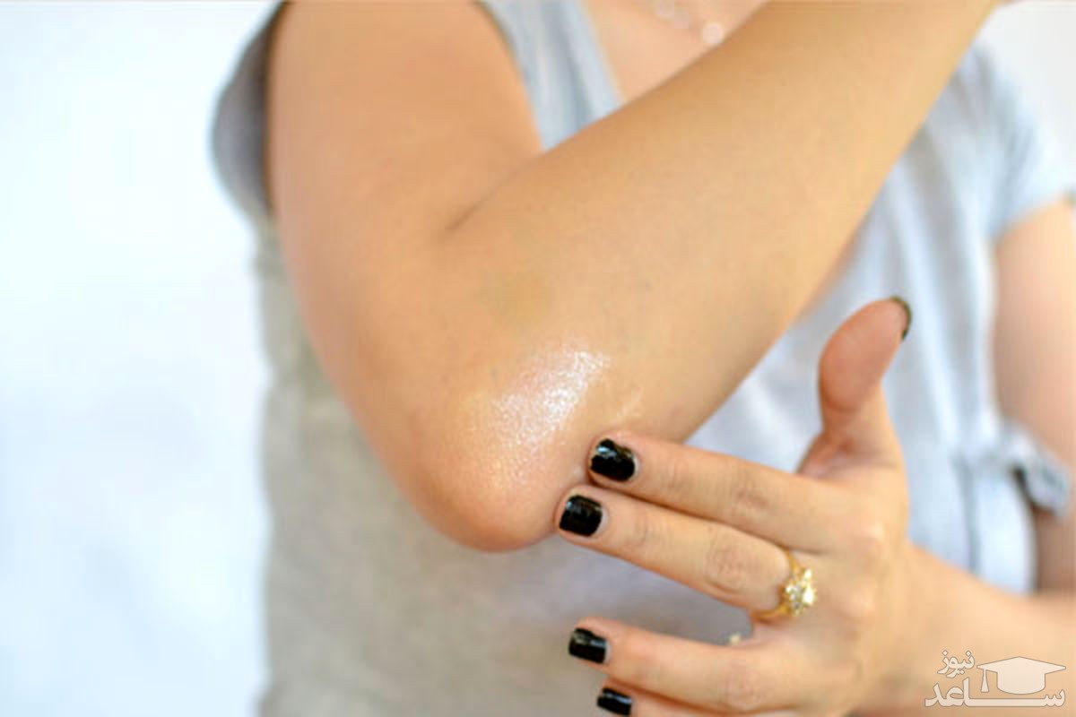 دیدن آرنج در خواب چه تعبیری دارد؟ /تعبیر خواب آرنج