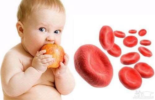 علایم و نشانه های کم خونی در کودکان و راه های درمان آن