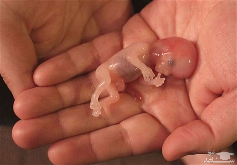 باورهای غلط و بی اساس درباره سقط شدن جنین