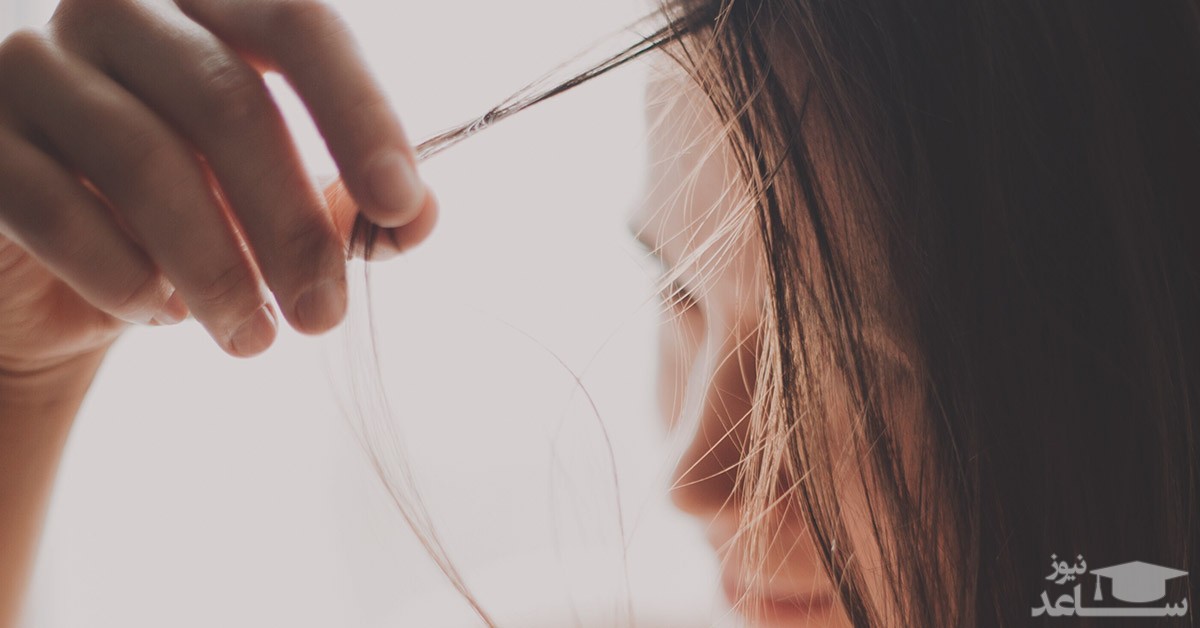 مهم ترین علل ریزش مو از دیدگاه طب سنتی