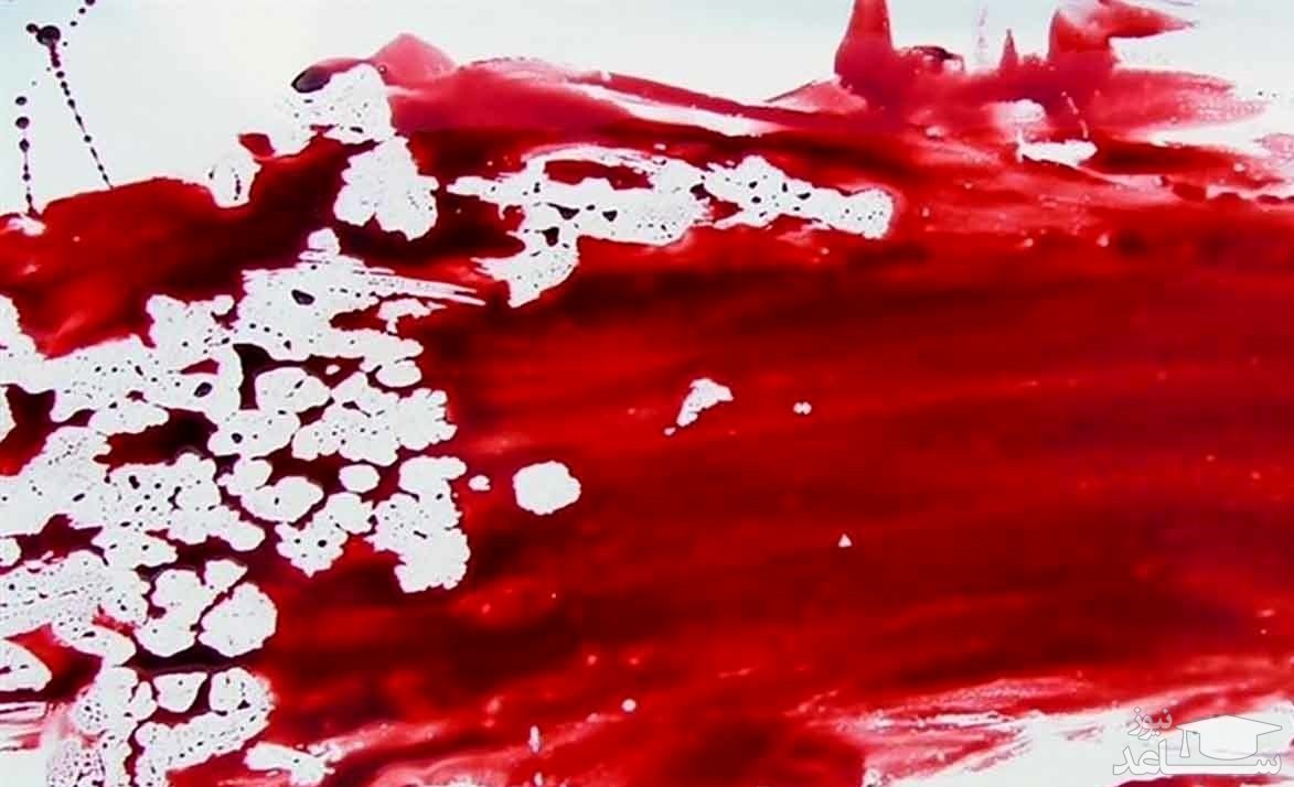 شکافتن قلب جوان 19 ساله با چاقو / جوان رودانی مرد و بعد زنده شد!