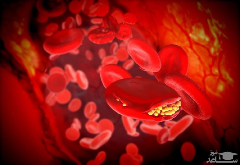 موانع منع مصرف و تداخل دارویی دالتپارین