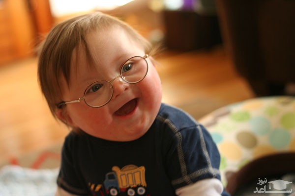 با کودکان مبتلا به سندروم داون چگونه رفتار کنیم؟