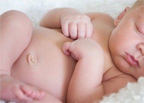 علل و علایم فتق ناف در نوزادان